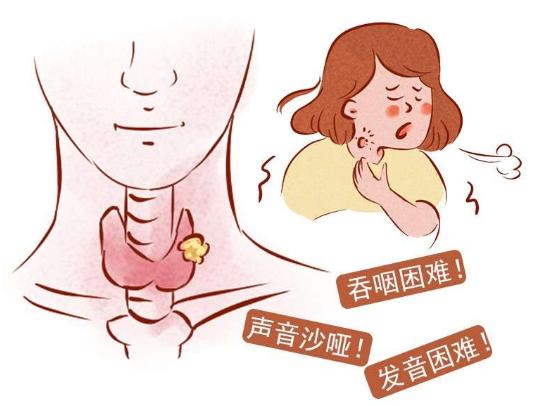 慢性咽炎的治疗误区有哪些