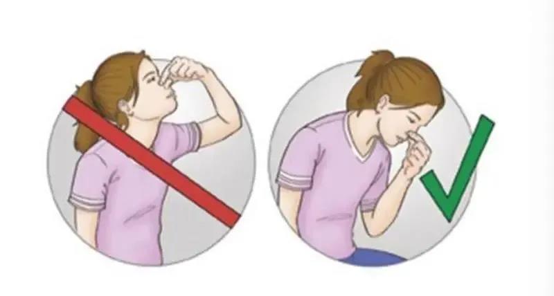 鼻出血的正确姿势