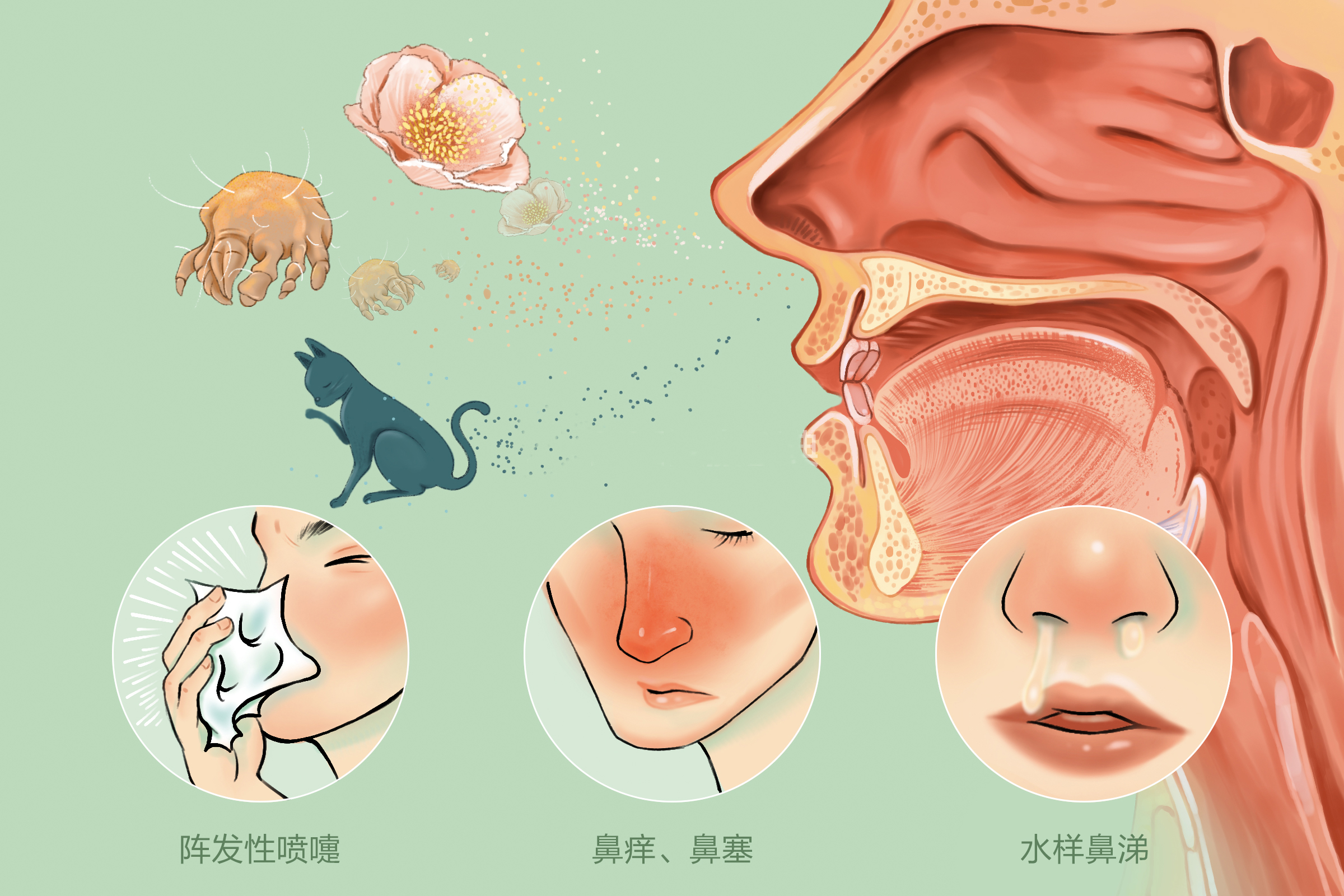 过敏性鼻炎的病因