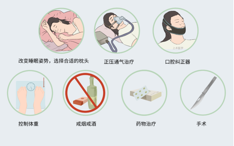 消除打鼾