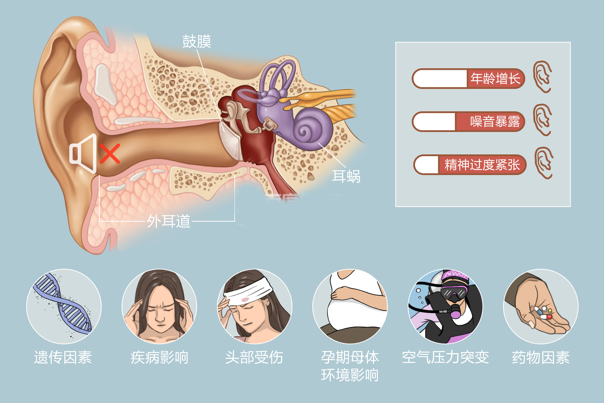 突发性耳聋