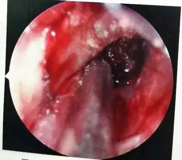 重庆耳鼻喉专科